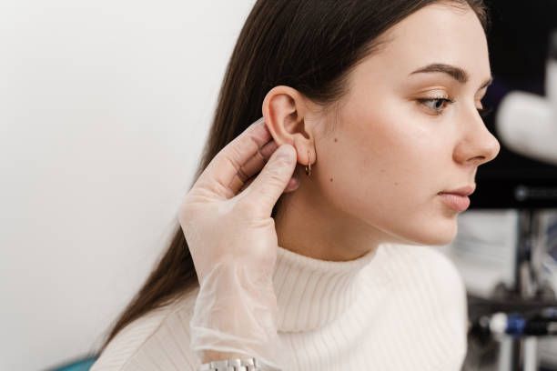 Otoplasty in Dubai