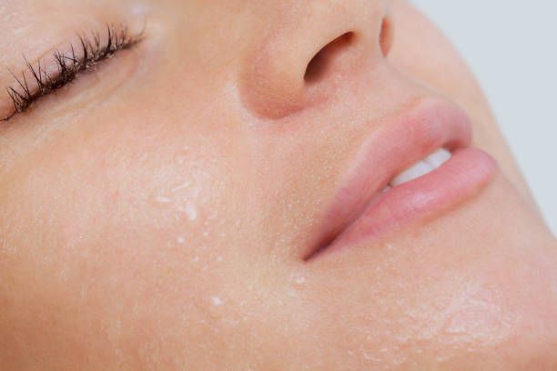 Cosmelan Peel in Dubai