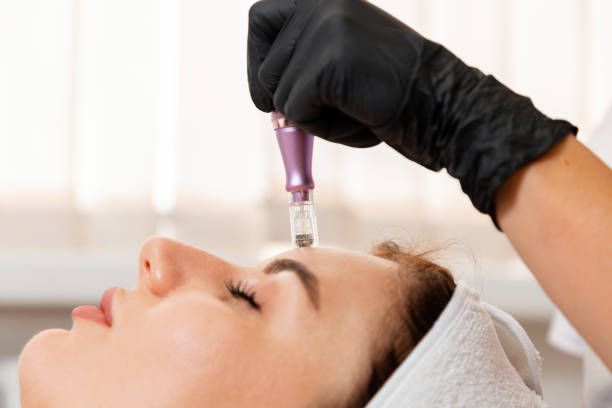 Dermapen Treatment in Dubai