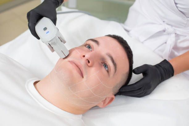Endolift treatment in Dubai