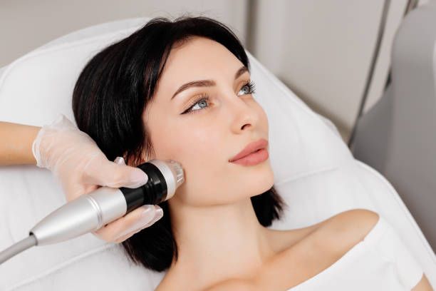 Fractional RF Microneedling in Dubai