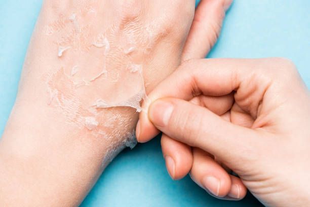 Inno Peeling in Dubai: The Science Behind the Glow