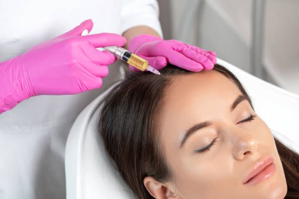 PRP hair treatment in Dubai