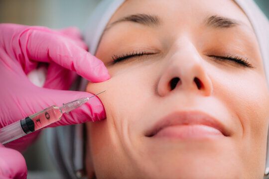 Dermal Fillers in Dubai