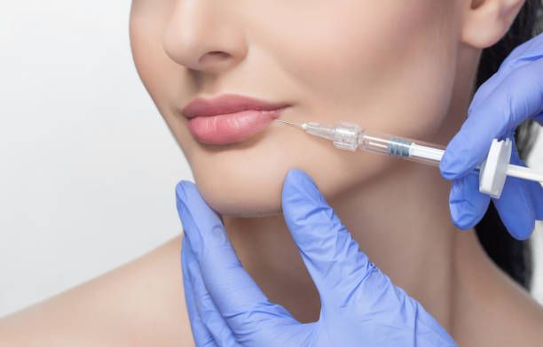 Fillers in Dubai