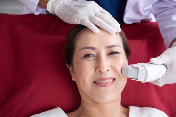 Does HIFU Treatment in Dubai Work for Double Chin?