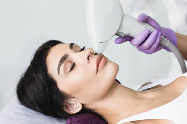 Laser Hair Removal in Dubai