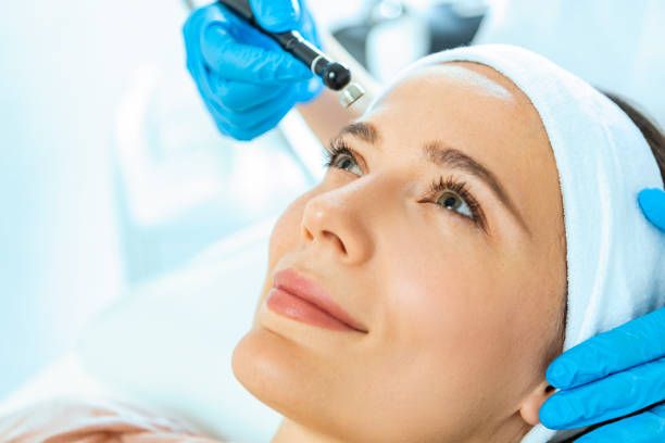 Microneedling Treatment in Dubai