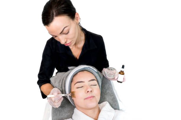 PCA Chemical Peel Treatment in Dubai for Acne Scars: Results
