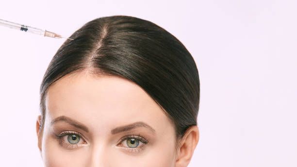 PRP hair treatment in Dubai