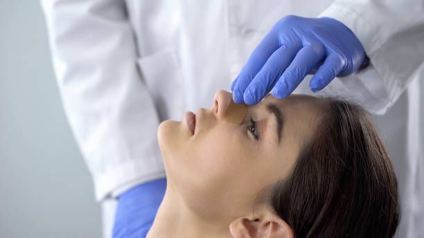 Rhinoplasty in Dubai for Hump Removal | Smooth Nasal Bridge