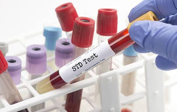STD Test in Dubai