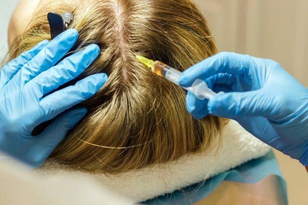 exosome hair in Dubai
