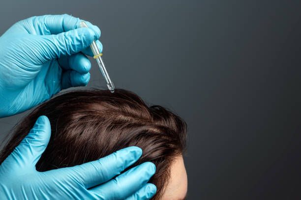 Exosome Hair in Dubai: The Science of Follicle Renewal