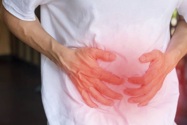 Hernia Surgery in Dubai
