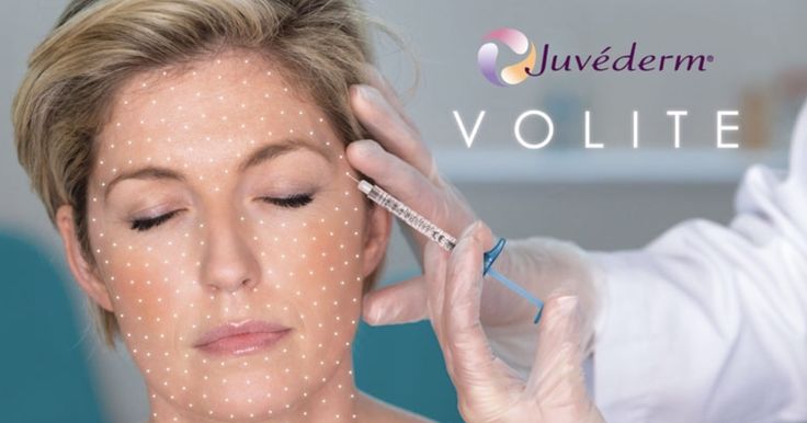 Volite Fillers in Dubai